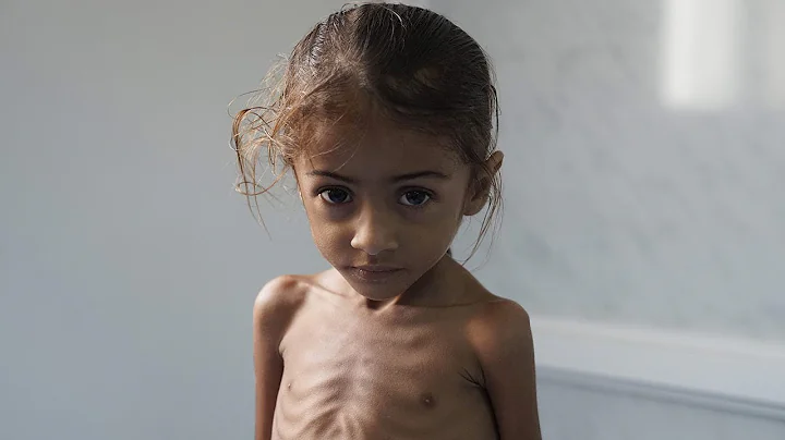 What’s Causing a Humanitarian Crisis in Yemen?