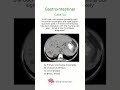 Gastrointestinal - Case 54