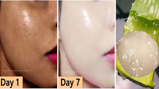 OMG ! it removed my Dark Spots Permanently in 2 DAYS|Apply Aloe Vera on Your Spots and See the Magic