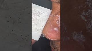 Download Lagu Score the lanbena blackhead remover today! #skincare #pores MP3