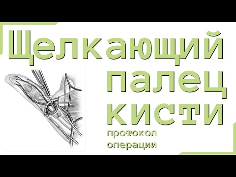 Вопрос: Как накладывать шину на щелкающий палец?