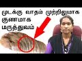 Mudakku vatham kunamaga marunthu rheumatoid arthritis marunthu in tamil