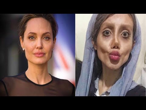 Video: Jinsi ya kutengeneza midomo na mashavu kama vile Angelina Jolie bila upasuaji wa plastiki? Sehemu ya 2