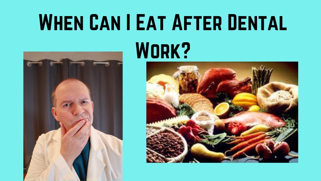 When Can I Eat After Dental Work? What Can I Eat After Dental Work?