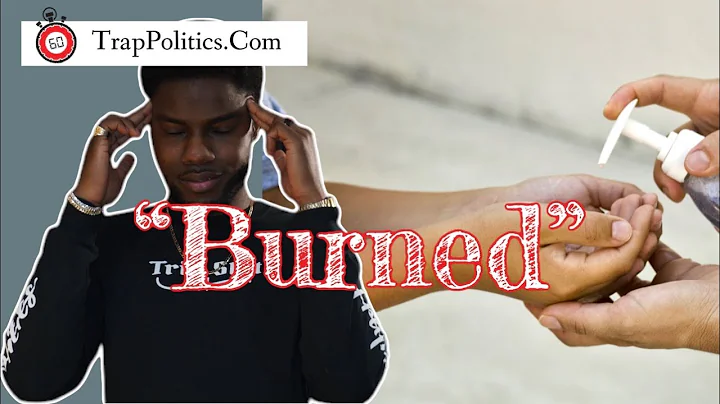 Granbury Middle School student burned with hand sanitizer