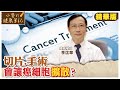 切片.手術會讓癌細胞擴散嗎? 腫瘤科名醫:錯誤觀念 @CtiNews  @CtiHealthyme  【#小麥的健康筆記】