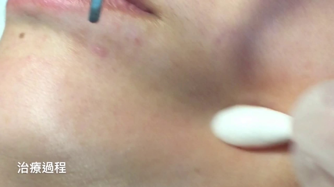 Age Restrict Video