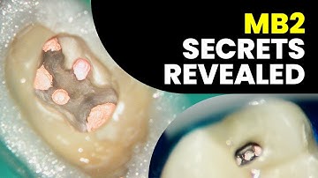 MB2 Canal - The Ultimate Guide To Finding It Every Time