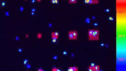 Calcium mobilization and activation of platelets on anti-PF4/Heparin immune complex microarrays