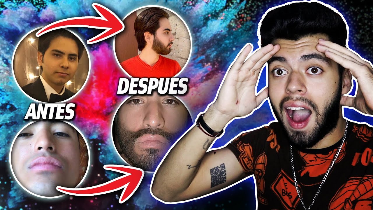 BARBAS INCREIBLES de MINOXIDIL!!