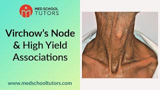 Virchow's Node and High Yield Associations for the USMLE screenshot 2