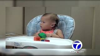 2-year-old now hears with the help of Cochlear implants