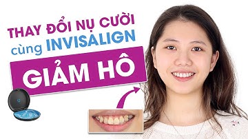 Niềng răng Invisalign giảm hô và chỉnh thẳng đường giữa lệch nhiều tại Elite Dental