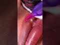 Neutralización labios oscuros 👄