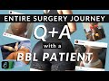 BBL Patient Interview on SURGERY, RECOVERY, FAJA’S + EVERYTHING you need to know | SIXSURGERY