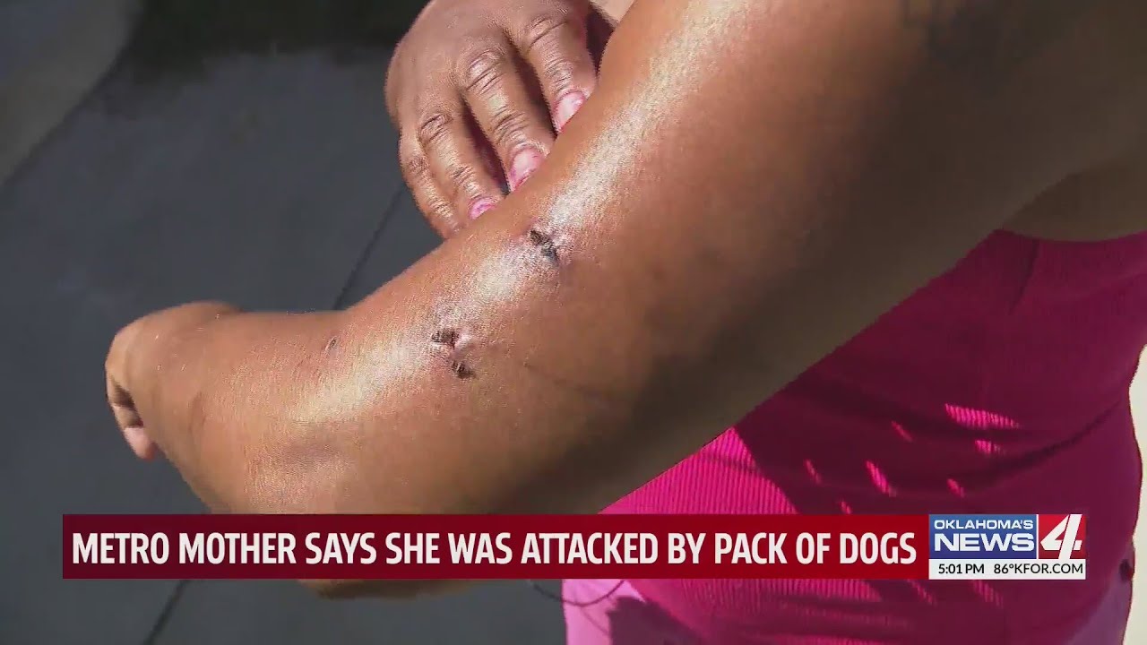 Metro mother says she was attacked by pack of dogs - YouTube