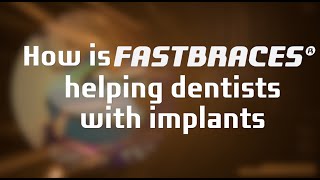 Fastbraces® Technology: How is Fastbraces® helping dentists with implants