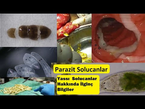 Yassı Solucanlar Hakkında Şaşırtıcı Bilgiler, Bağırsak Tenyası, Trematoda , Turbellaria, Cestoda