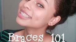 Braces 101: Types,Cost,& How to get them CHEAP! 