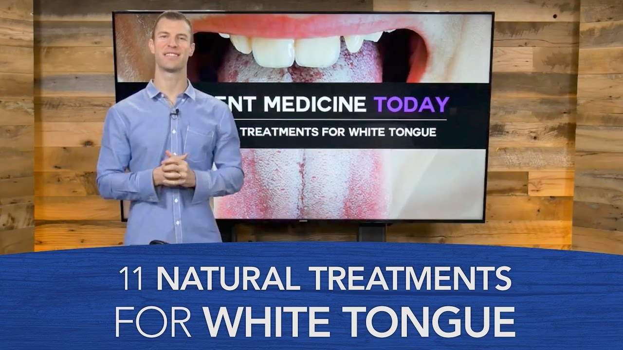 How To Get Rid Of White On Tongue