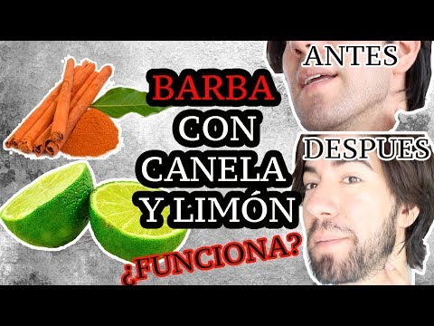 Vídeo: Tratamiento Del Bigote Dorado: 5 Medicinas Caseras