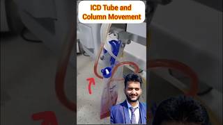Icd Tube