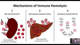 Autoimmune Hemolytic Anemia