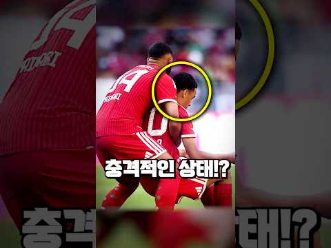 김민재 동료가 쓰러진 순간 케인이 보여준 놀라운 반응