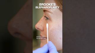 Brooke Schofield’s Eyelid Lift Results 👀✨