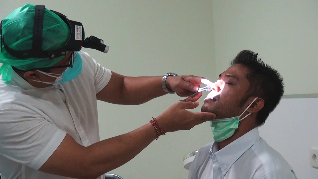 Video Pemeriksaan THT