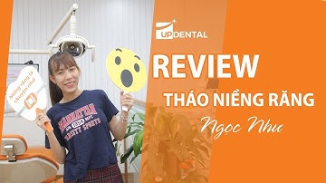 [Review niềng răng]: #62 Kết quả niềng răng của Ngọc Như