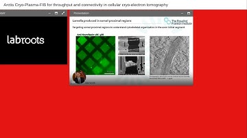 Arctis Cryo-Plasma-FIB for throughput and connectivity in cellular cryo-electron tomography
