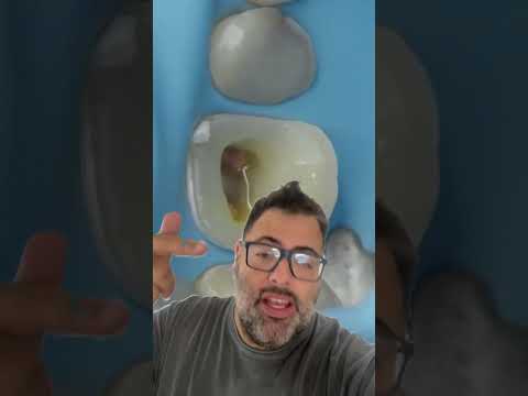 DENTE COM TRATAMENTO