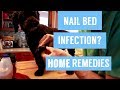 Dog nail infection 7 holistic remedies