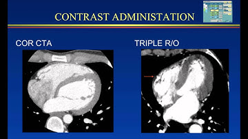 Pros and Cons of Triple Rule Out
