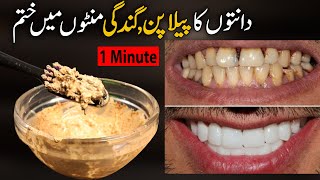 TEETH WHITENING AT HOME | removing the yellowness and tartar accumulated in the teeth,? effective