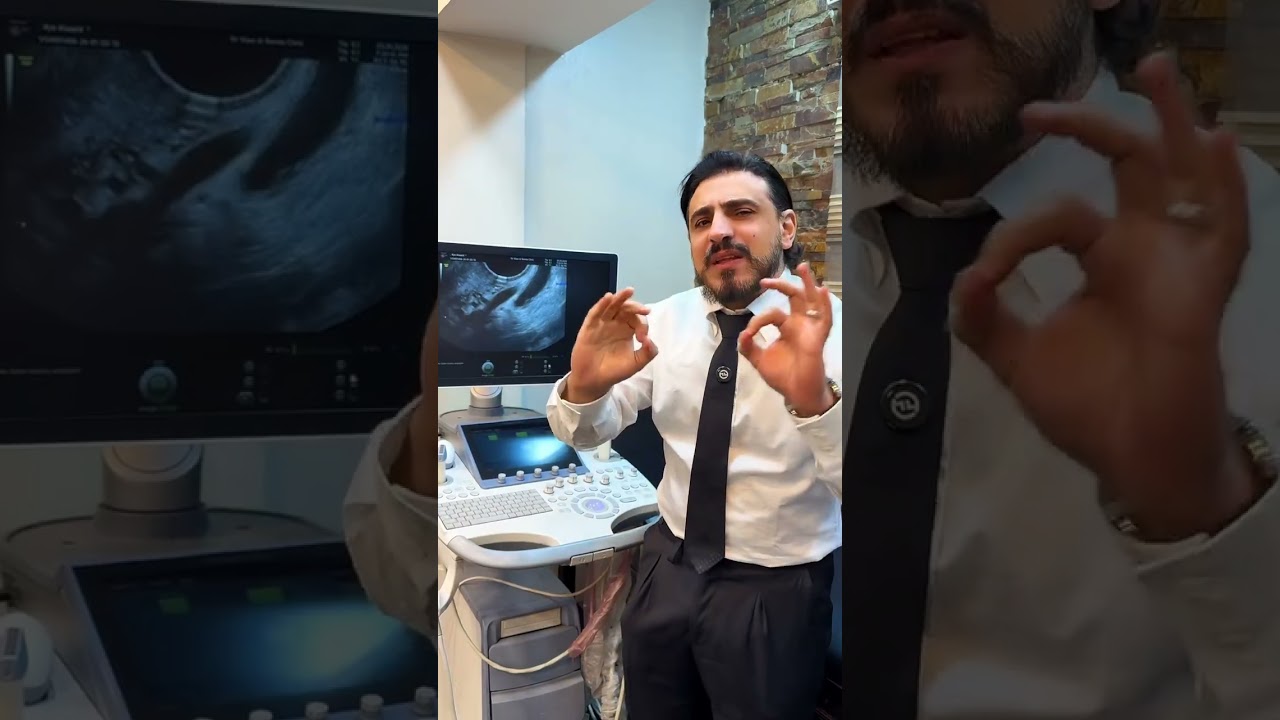 الم الحالب و الارجل في حالات  #البطانه_المهاجره و #الحصوات #د_وائل_البنا♠️