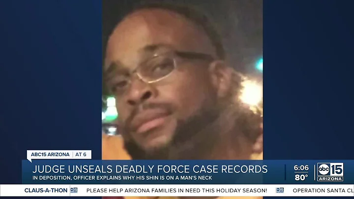 In deposition, officer explains why his shin was o...