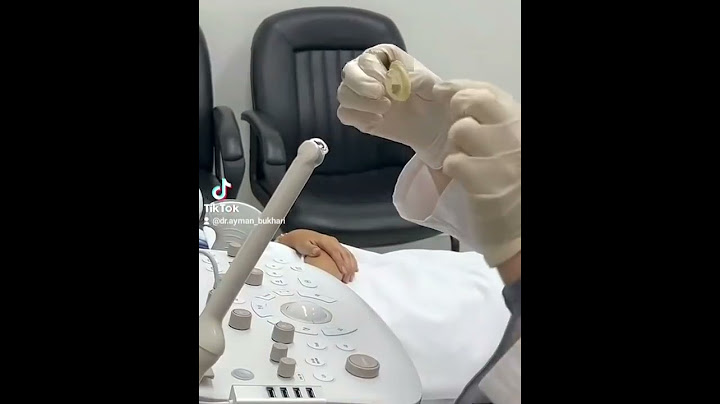 سونار مهبلي