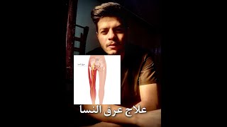 عرق النسا_اهم اسباب عرق النسا الحقيقي والكاذب piriformissyndrome