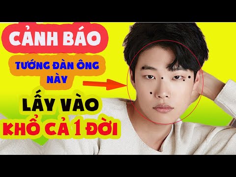 5 Vị Trí Nốt Ruồi Cực Xấu Trên Mặt Đàn Ông Ai Có Xóa Ngay Kẻo Ế Đến Già