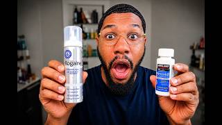 Minoxidil Beard Transformation After 4 Months — Is It Worth It?