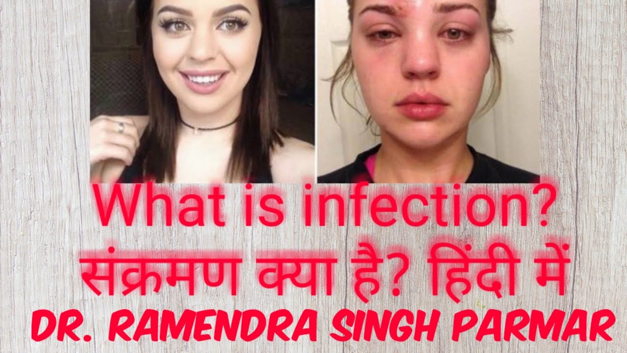 Infections and types of infection in Hindi. संक्रमण क्या है पूरी