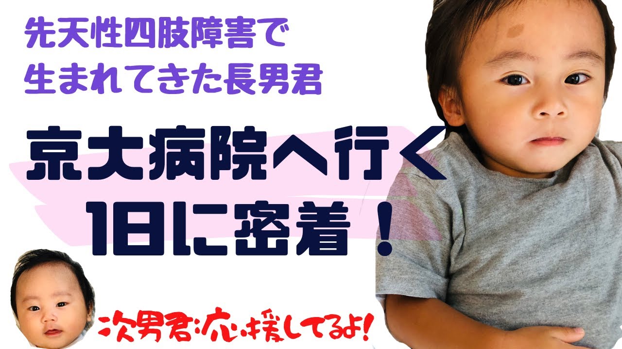 指欠損症の動画 画像 動画検索 マイルドサイト