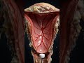 Uterine polyps are growths in the womb that can lead to heavy bleeding, irregular periods.