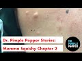 Dr. Pimple Popper's Weekly Story Time: Momma Squishy, Chapter 2