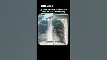 "Even Doctors Are SHOCKED by How Fast AI Is Moving! 😳🤖" #ai #artificialintelligence