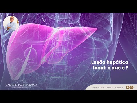 Vídeo: Na flexura hepática o?