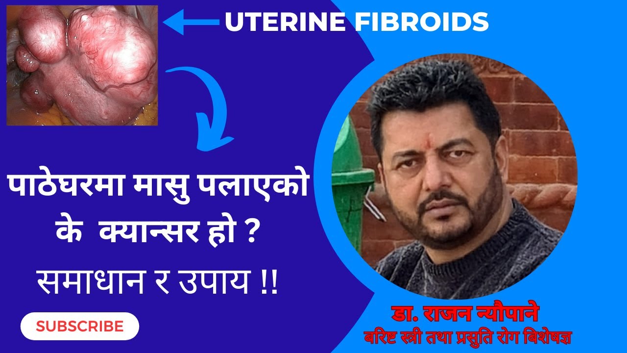 पाठेघरमा मासु पलाएको (UTERINE FIBROIDS) के क्यासर हो ? समस्या र उपाए !!