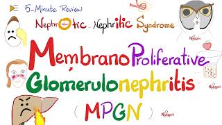 Membranoproliferative Glomerulonephritis (Type 1 and 2) | MPGNI & MPGNII | Nephrology